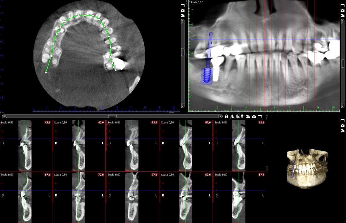 RADIOLOGIA 3D/CBCT